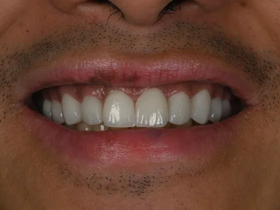 After: Harmonised shape and colour