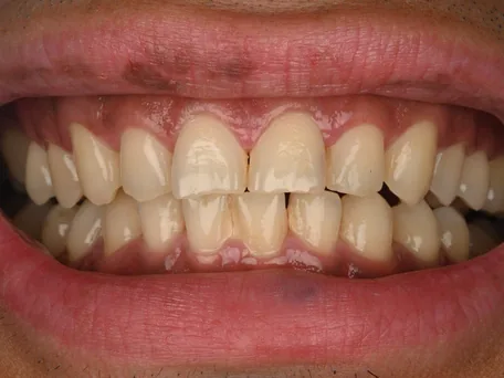 Before: Harmonised shape and colour